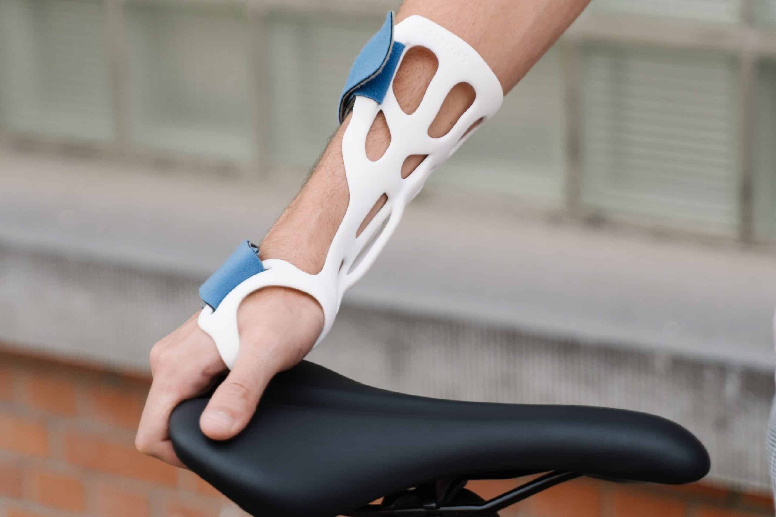 Image of a 3D printed cast on a man's wrist